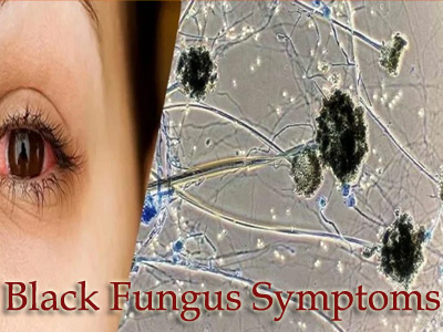 Black Fungus Symptoms